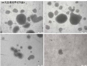 使用Corning® NK细胞无血清培养试剂盒II 高效地激活和扩增人类自然杀伤细胞 应