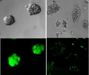 PLOS ONE:细菌的“通讯系统”可用于阻止或杀死癌细胞