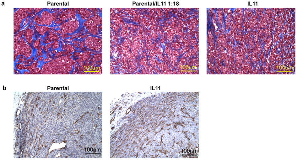 IL11在肿瘤微环境上的影响
